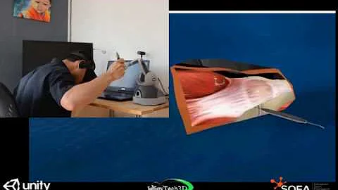 SOFA-Unity - Virtual Reality Orthopedic simulation using Haptic Tool