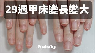 指甲萎縮-矯正成修長美甲，咬指甲 指甲短短寬寬 變成 甲床又大又長！
