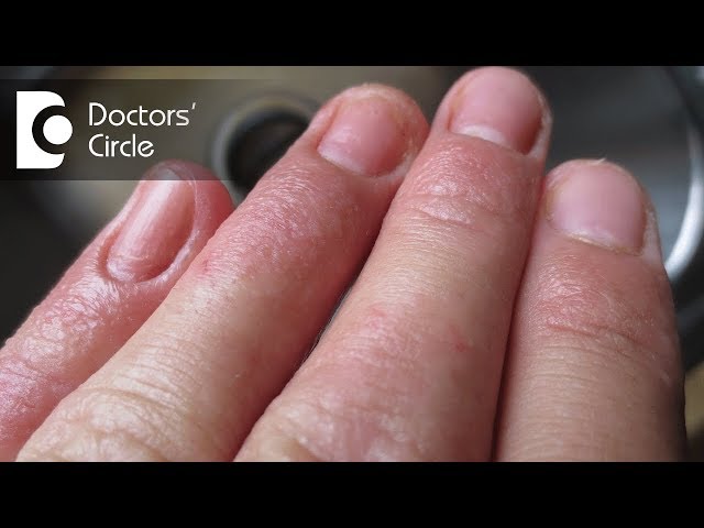Home gel kit dangers & 6 ways to prevent allergies at the nail desk –  Scratch