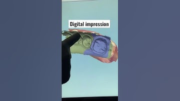 #digital #impressions are fun #itero