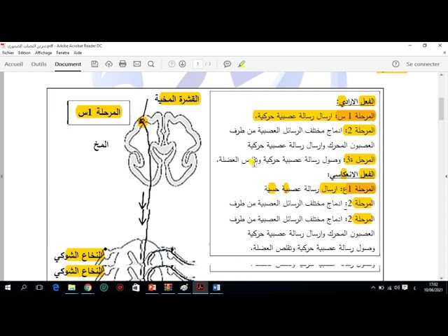 العرض 18 حل الجزء الاول من تمرين التصلب الجانبي الضموري