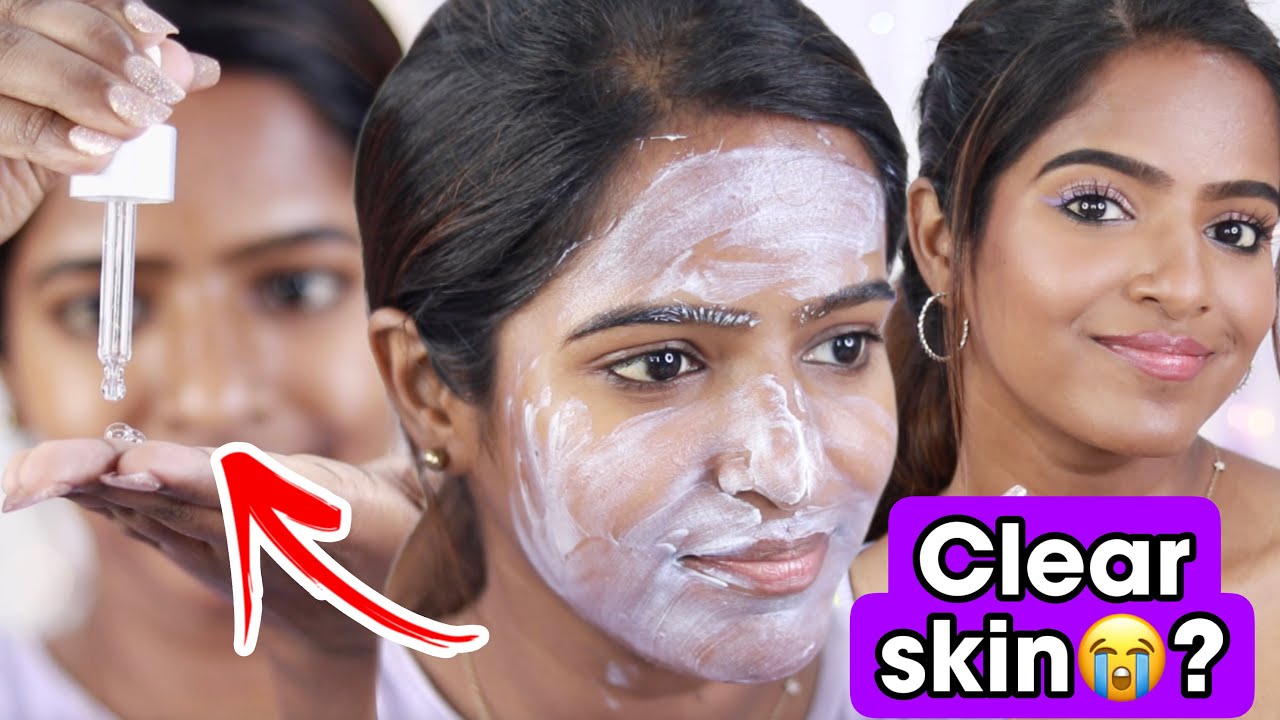 Quick Daily Morning Skincare For EXTREME Acne YouTube