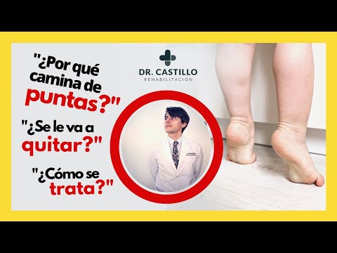 Video: ¿Por qué mi bebé camina de puntillas?