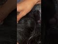 #fypviralシ #statisfying #lice #hair #LiceOnHead #liceremoval #brasil #xyzbcafyp #licecomb #kutu