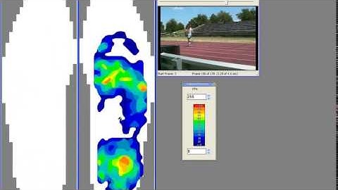 F-Scan™ Wireless for In-Shoe Plantar Pressure Analysis