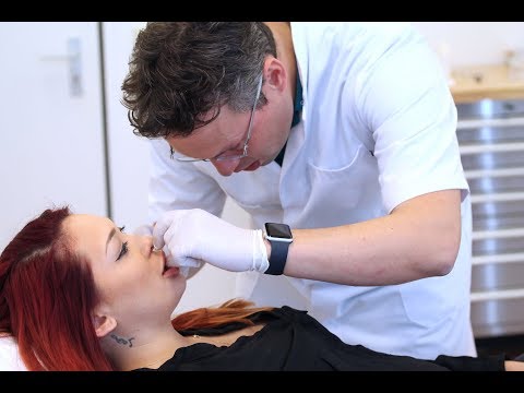 Larra's lipbehandeling met fillers