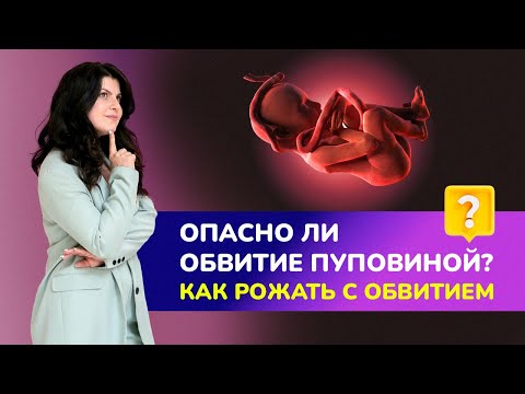 Опасно ли обвитие пуповиной? Как рожать с обвитием