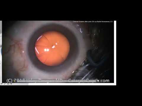 Video: Los Ojos Lo Tienen - Parte 2 - Emergencias Oculares Equinas