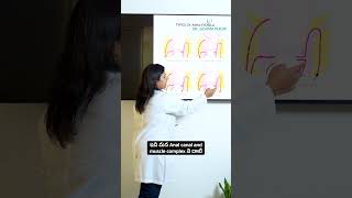 Anal Fistula Types Explained | Intersphincteric to Extrasphincteric | Dr Sushma Peruri #Fistula