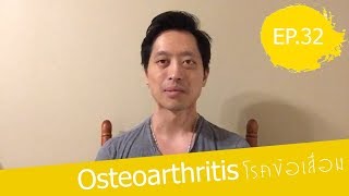 โรคข้อเสื่อม (Osteoarthritis) โดยนายแพทย์จักรีวัชร