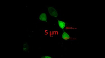 Hep2 TRPM2 video 2 5 D