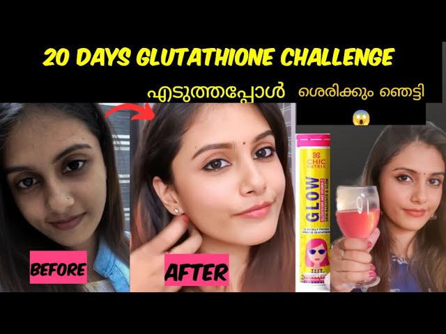 glutathione chicnutrix Glutathione Tablets for Skin Glow & Pigmentation main image 1