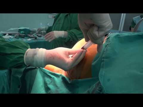 Palindrome 55 Cm Lt Fem V
