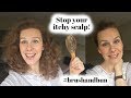 How I fixed my itchy scalp | Curly Girl Method #brushandbun