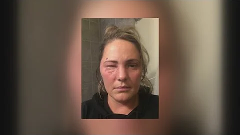 Danger of fireworks & How to avoid injury