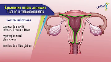 Comment sont les saignements d'un cancer de l'utérus ?