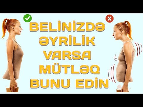 Video: İdmanla Ayaqların əyriliyi Necə Düzəldilir