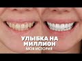 Виниры в Турции в 2 раза дешевле. Реальный отзыв о Myra Dental Clinic. Цены стоматологии Анталии.