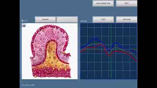 Automate 8D NLS  9D NLS  3d LRIS VECTOR  NLSto get list of microorganismes  WWW.8DNLS.NET