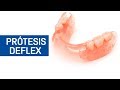 Qué son las prótesis deflex / Odontoespecialistas