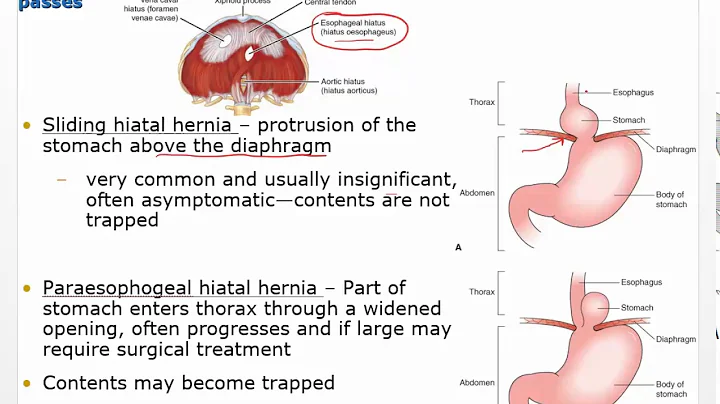 Chapter29 Video   Disorders of GI function - DayDayNews