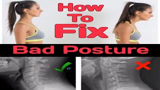 Fix Bad Posture Anterior Head Carriage Dublin Chiropractic Back Pain Treatment Dublin