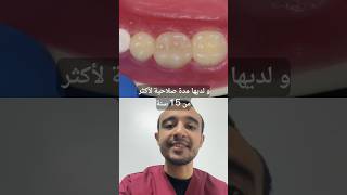 فوائد جسر الأسنان ؟ طبيب_أسنان المغرب dentiste maroc