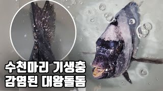 이런 최악의 기생충 감염은 처음이네요ㅠ