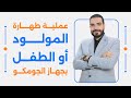 عملية طهارة المولود او البيبي او الطفل بجهاز الجومكو الختان او الطهاره بجهاز الجومكو د محمد علام عملية طهارة المولود او البيبي او الطفل بجهاز الجومكو الختان او الطهاره بجهاز الجومكو د محمد علام