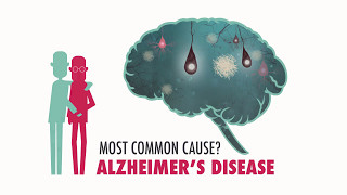 Epad Introduction English