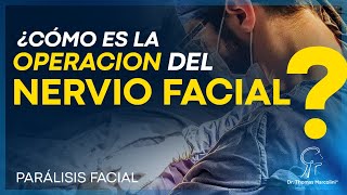 ¿Cómo se repara el nervio facial? ¡Entiende la cirugía!