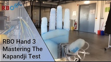 RBO Hand 3 mastering the Kapandji test