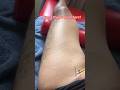 guess the problem [hint] chronic pain treatment