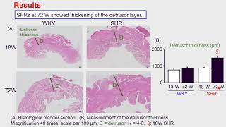 #124 Aging causes polyuria and bladder overdistension in spontaneously hypertensive rats