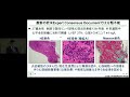 2023年改訂版 心筋炎の診断・治療に関するガイドライン