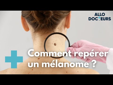 Mélanome