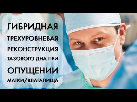 Гибридная трехуровневая реконструкция тазового дна при опущении матки/влагалища: базовая операция