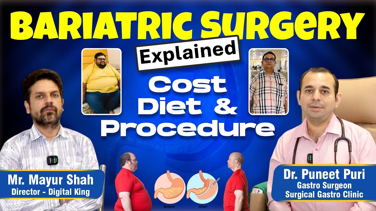 Bariatric Surgery Explained: Cost, Diet & Procedure| Podcast | Dr. Puneet Puri | 9670937932 | Kanpur