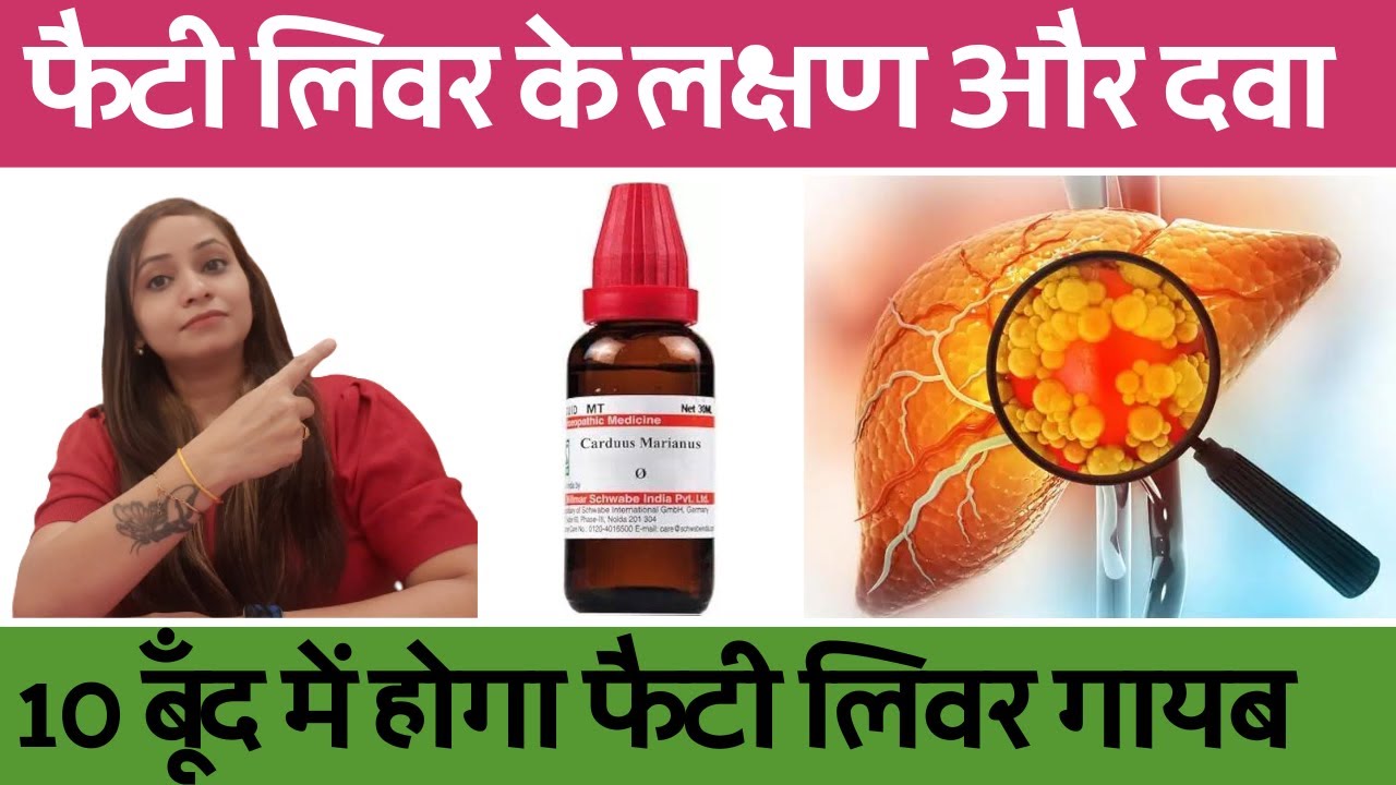 फैटी लिवर के लक्षण और ईलाज |fatty liver grade 1, grade 2 Treatment |Fatty liver homeopathic medicine