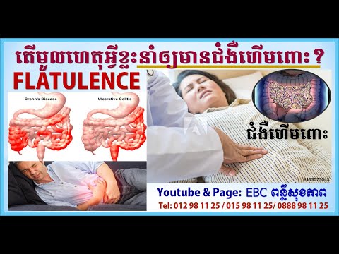 EBC ពន្លឺសុខភាព - ហើមពោះ  Flatulence - English (Pang Leehouv)