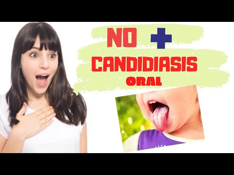 Vídeo: Tratamiento De Enfermedades De La Mucosa Oral Con Remedios Y Métodos Populares