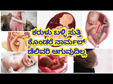 Umbilical cord / ಹೊಕ್ಕಳು ಬಳ್ಳಿ ಮಗುವಿಗೆ ಸುತ್ತಿಕೊಂಡರೆ ಏನು ಅರ್ಥ /Nutual cord ಎಂದರೇನು