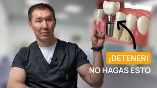 NO DEBES PONERTE IMPLANTES. 5 DATOS PRINCIPALES QUE DEBES SABER