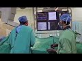 Coronary angiography  dr aritra konar  interventional cardiologist  apollo hospital  kolkata