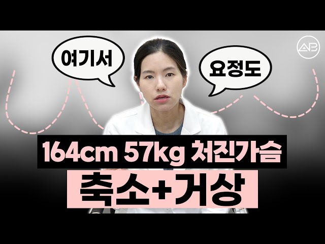 너무 커서 처졌던 가슴, 이렇게 달라짐 | 성형비포애프터 | 에이비성형외과