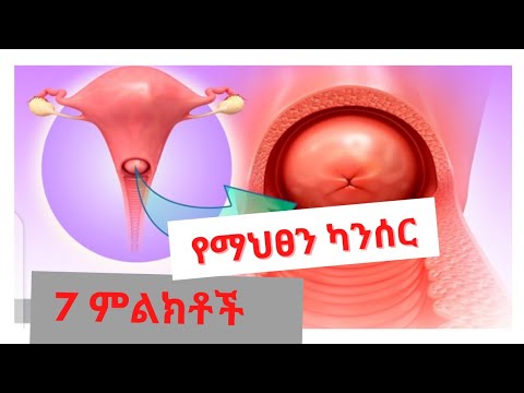 7 የማህፀን ካንስር ምልክቶች ና መፍትሄዎች(የማህፀን ካንሰር(7 symptom suggestive of cervical cancer)