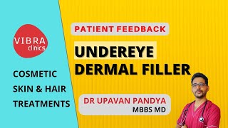Cosmetic Dermal Fillers Injection I Got Filler For Under Eye Dark Circles In Udaipur Best Result