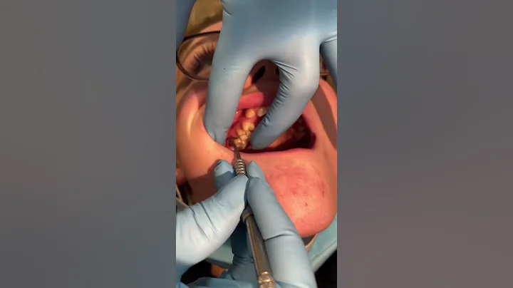 Pop goes a baby tooth!