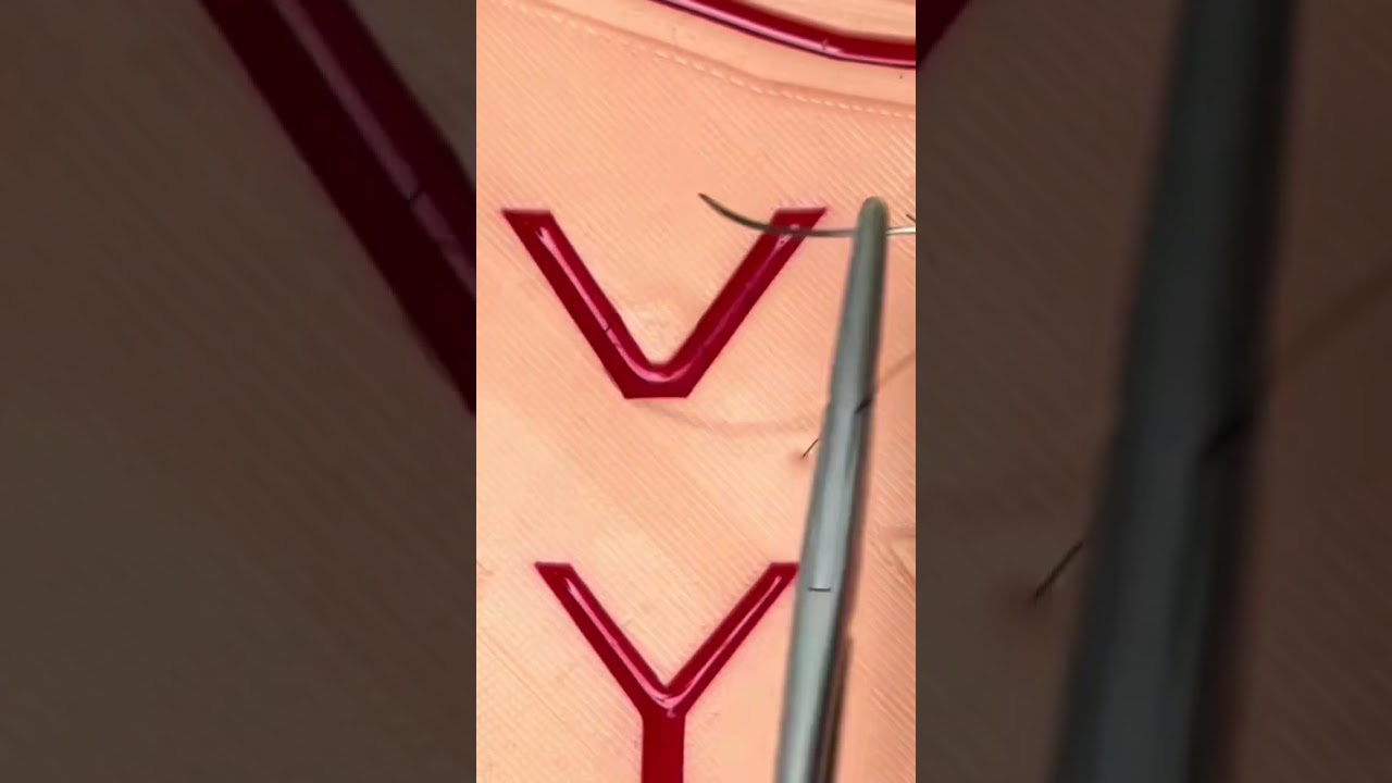 Magic Suture for V-Shaped Wounds! 😷 