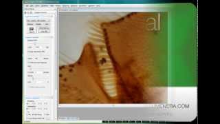 Lumenera's INFINITY ANALYZE Software Tutorial: Dynamic Zoom Function